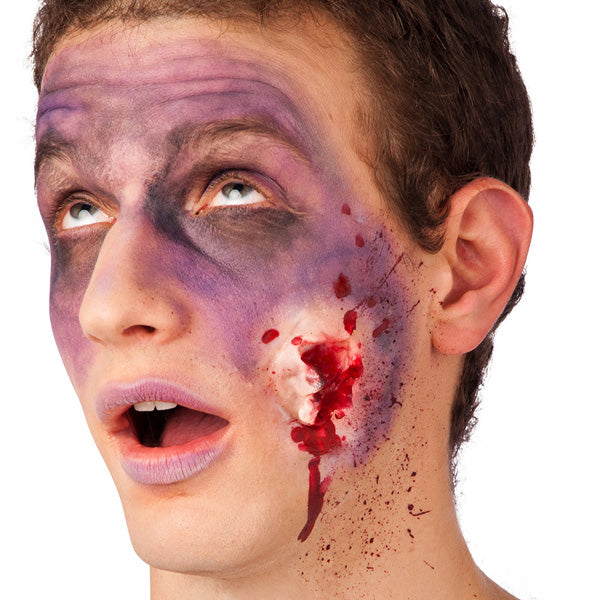 Scar With Broken Bone