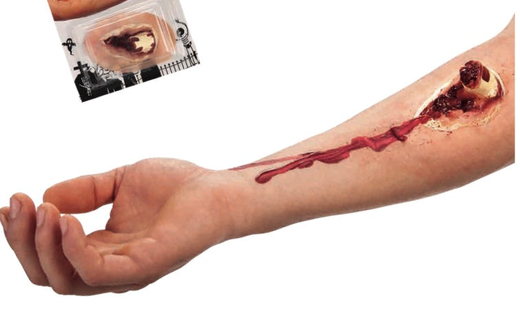 Scar With Broken Bone